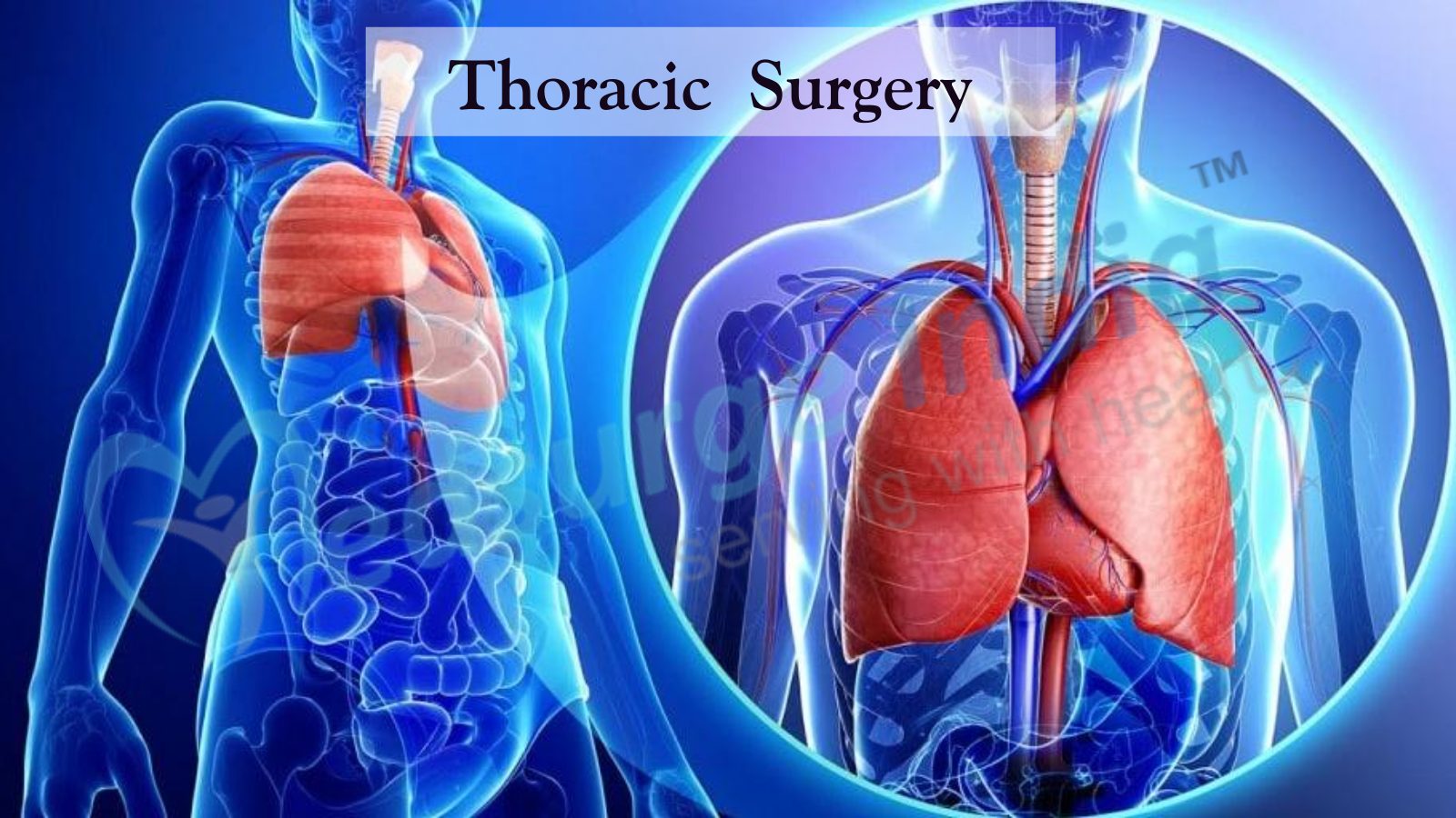 What Is Thoracic Surgery?